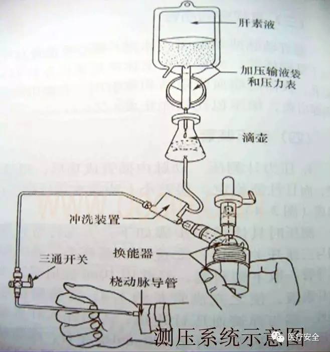 测量动脉血压的原理是什么_肱动脉测量血压图片(3)