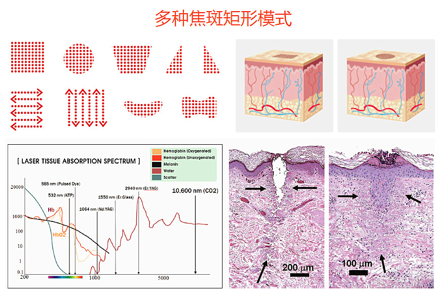 co2激光是什么原理_co2是什么气体(2)