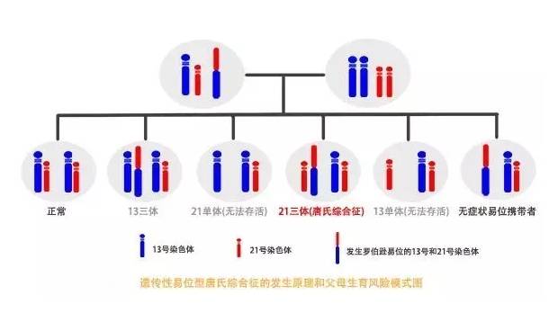 【坐诊】反复流产,可能是染色体罗伯逊易位!