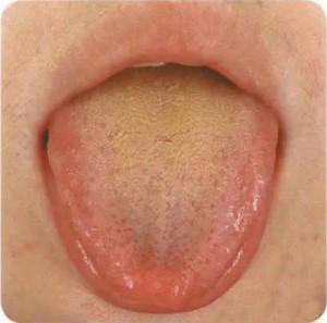 舌头吐露的身体秘密:看看舌头,便知你是哪种体质