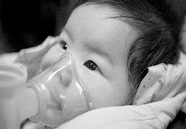 室内空气环境污染导致婴幼儿的免疫力和智力降