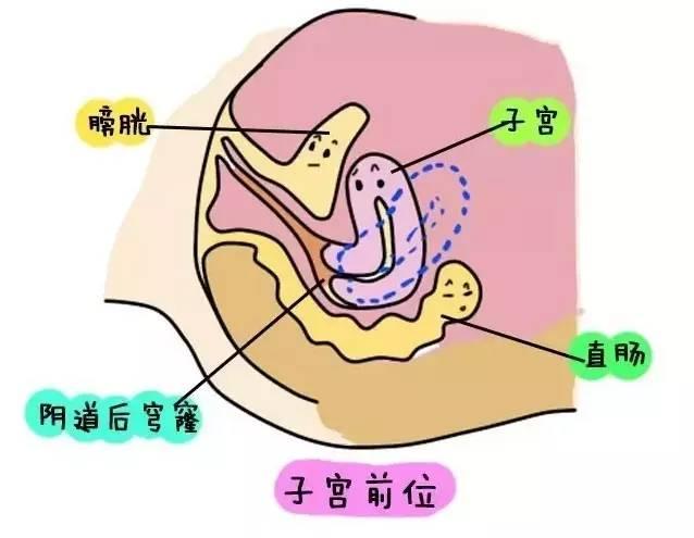 子宫的位置有中位,前位,后位之分.