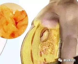 那么包裹着心脏的脂肪是怎么来的呢?