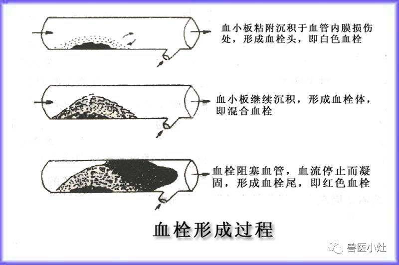 教育 正文  b,混合血栓  c,红色血栓  d,透明血栓  e,败血型血栓 2.