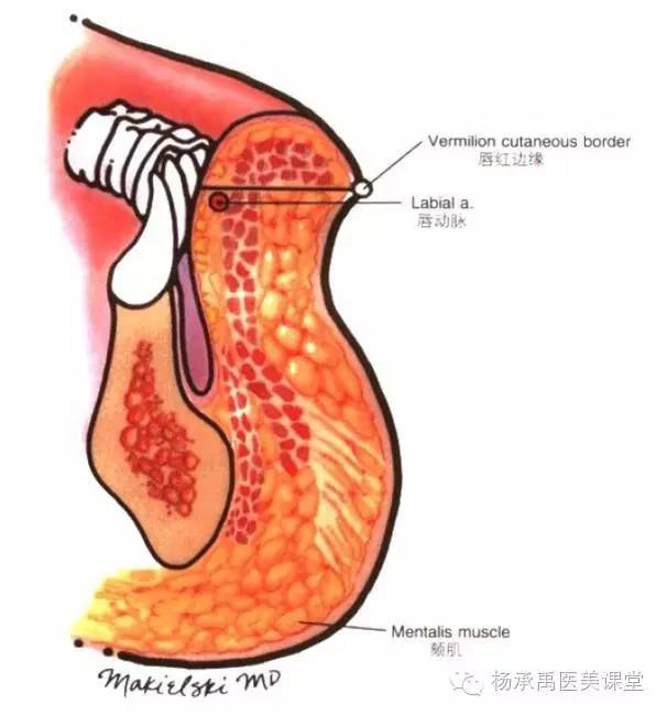 从唇的外侧联合点画出一条线至外眦;从鼻翼下表面画另一条线至耳屏上