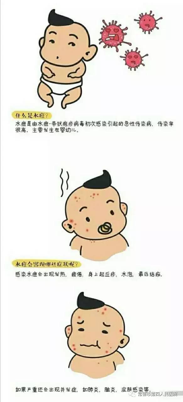 注意消毒与清洁 如宝宝感染上水痘,他的被褥,毛巾,敷料,玩具,餐具等