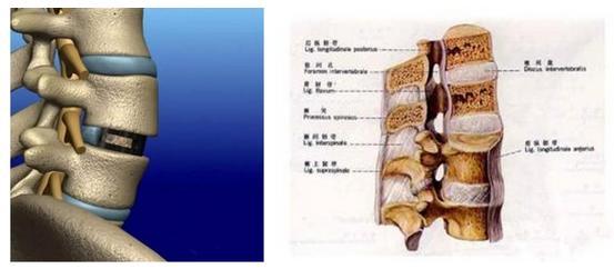 剖析腰椎间盘的功能特点,有效防治腰椎间盘突出