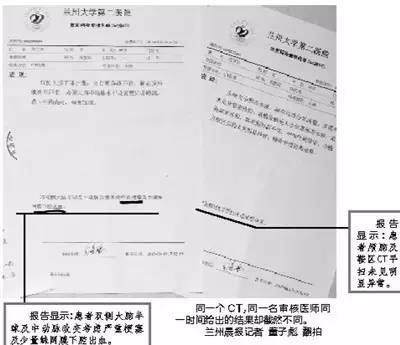 放射科医生修改CT报告,被判罚25619元导语3月