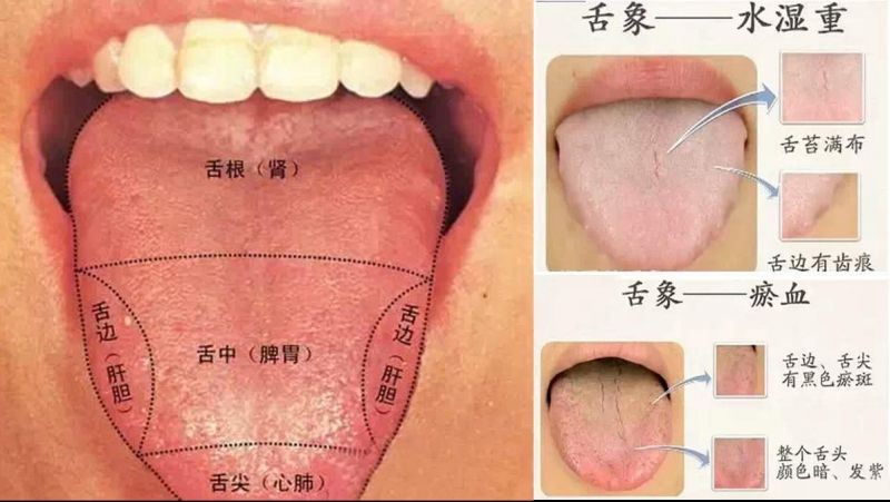 正常的舌头是舌体胖瘦适中,转动灵活,舌质淡红润泽,舌苔薄白,颗粒