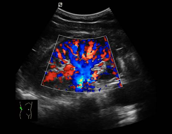 即时助手肾脏超声诊断指南