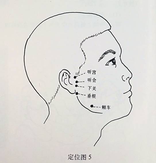 耳部穴位示意图