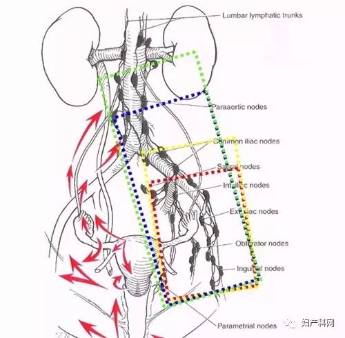 髂总水平第一水平:髂内及髂外水平querleu,morrow将腹膜后淋巴结切除