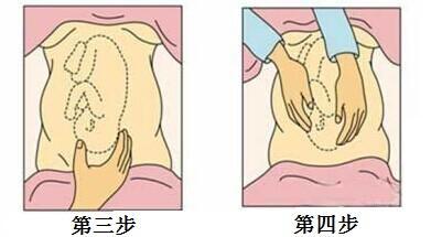 4步手法教你测知胎位,90%的孕妈都不知道哦