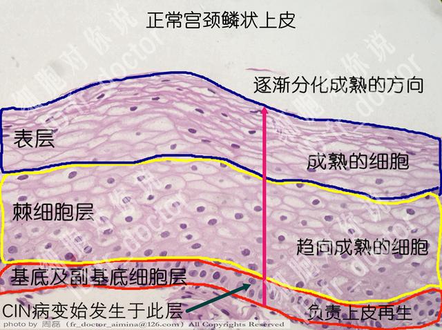 下图显示的是正常宫颈鳞状上皮的纵截面.