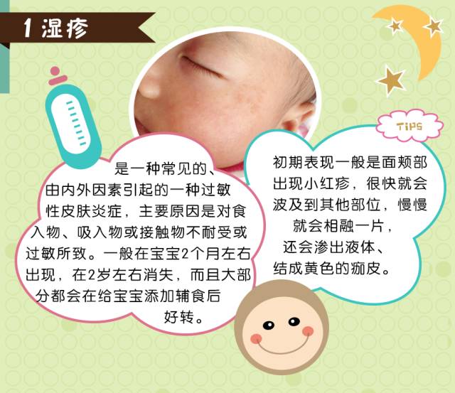湿疹属于过敏现象,最好的预防方法就是在平时注意让宝宝远离过敏源.