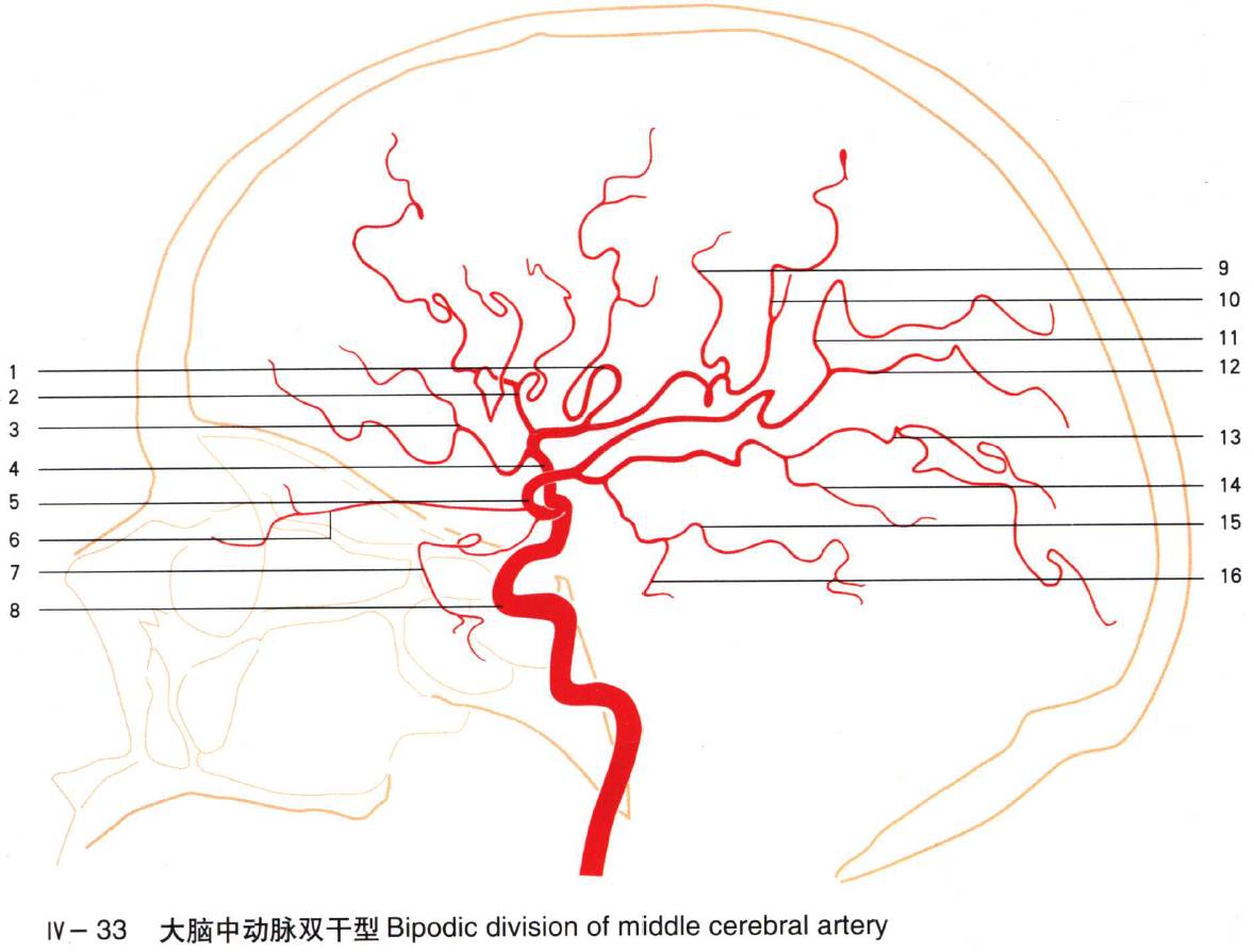 介入微课堂│珍藏系列之最全面的大脑中动脉【绘图 dsa 实体解剖】