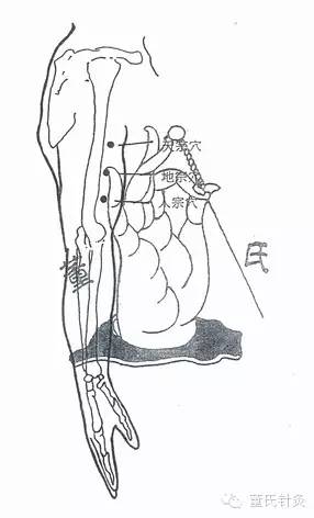 董氏针灸通经活络调理脾胃宣肺利喉的特效穴位人宗地宗天宗穴