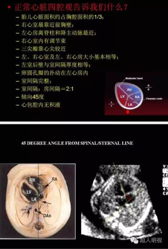 胎儿心脏检查注意要点