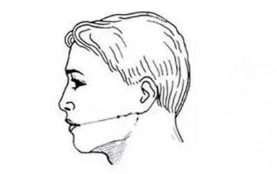 总之,想要避免松弛下垂,注射位置在耳垂和口角连线的下方区域就对了.