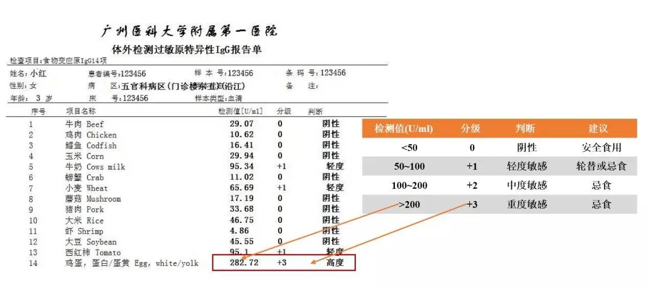 健康附一以健康的名义大盘点过敏你所需要做的检测项目都有哪些