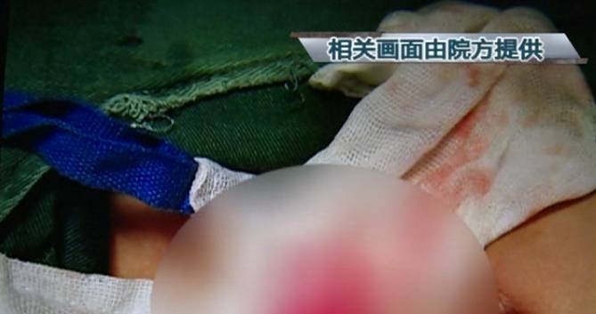 江西11岁男孩走路撅屁股 