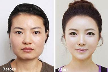 亚洲女性的扁平脸,这样修容,速变立体小v脸!