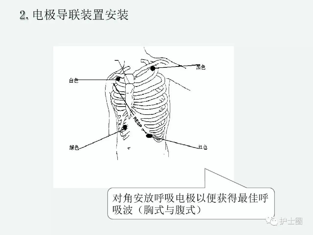 心电监护仪的操作及注意事项