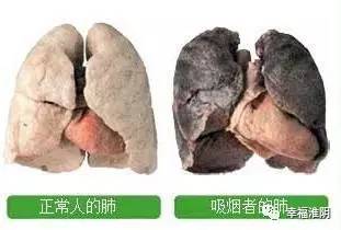 请转给吸烟的家人,戒烟后1天,1个月,1年的变化,老烟民