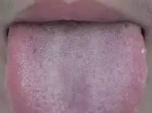 如果你的舌苔是这种颜色,可能大病在靠近!