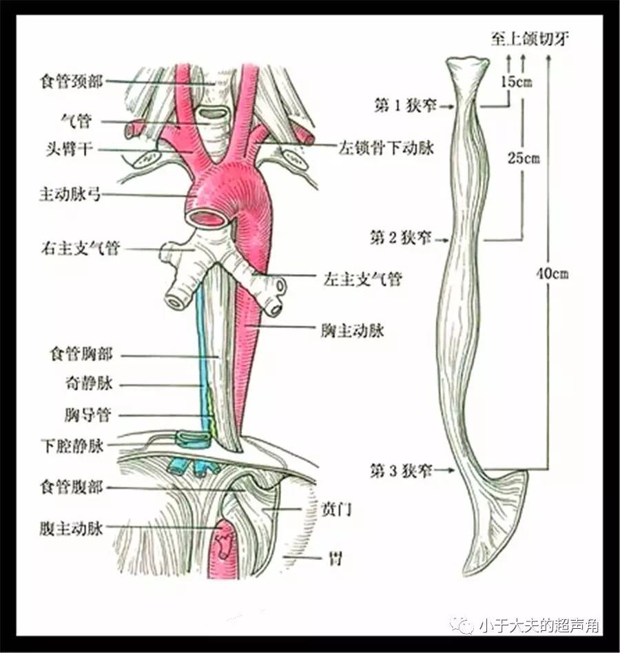 图6:食管的解剖位置以及三个狭窄 食管壁分四层,分别为粘膜层,粘膜