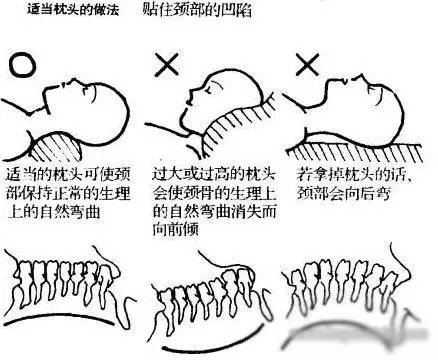 男子治疗颈椎病入院三天后竟去世 请大家对自己的颈椎