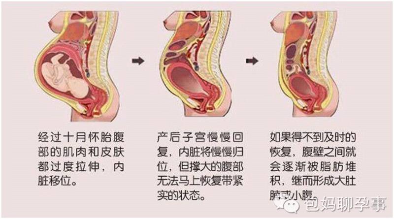 小产后肚子大怎么办