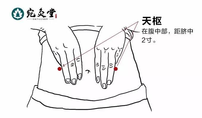 艾灸知识:天枢穴,疏调肠腑,理气消滞,通便