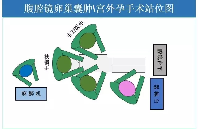 最形象的手术室站位图做不对你就out啦