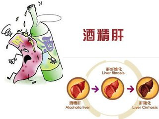 如何才能控制自己不喝酒?