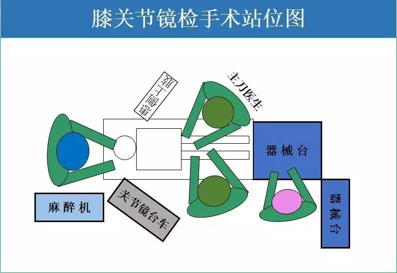 工作站均放置于患者健侧 此站位图适用于腰椎通道&导航类手术