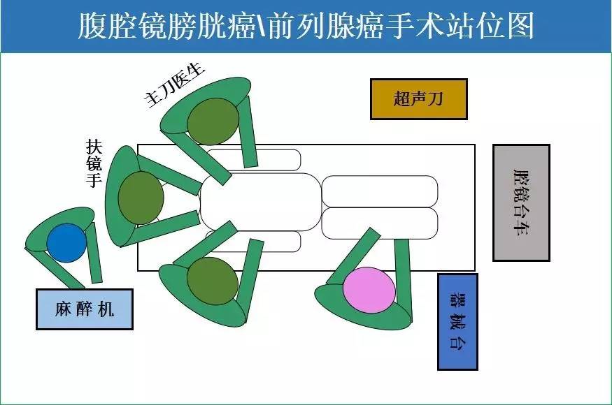 1,四名医生分别坐于患者双下肢两侧 2,器械台应与手术床对接 此站位图