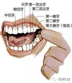 没有对咬牙:前面提过,不是每个人四个智齿都会长齐的.