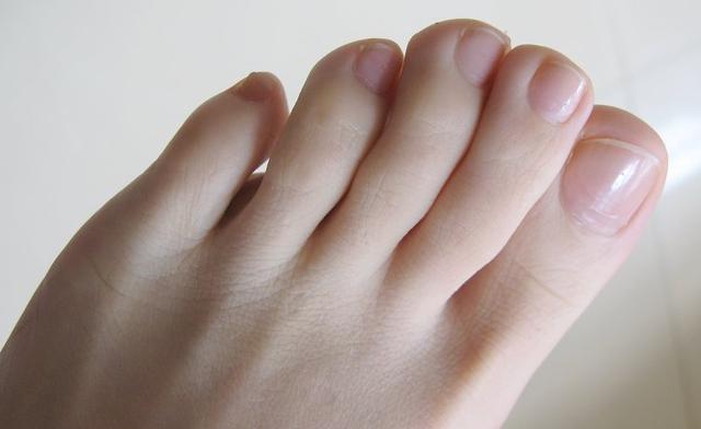 看趾甲: 一般健康人的脚趾甲呈粉红色,趾甲上也有月牙,约占趾甲的1/5