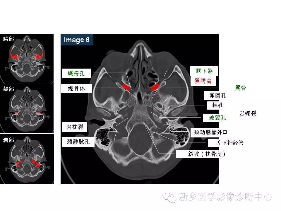 鼻咽部的详细解剖(含各个孔道)