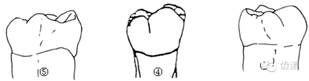 牙冠的颊舌径比近远中径缩小显著,整个牙体呈圆形.2.