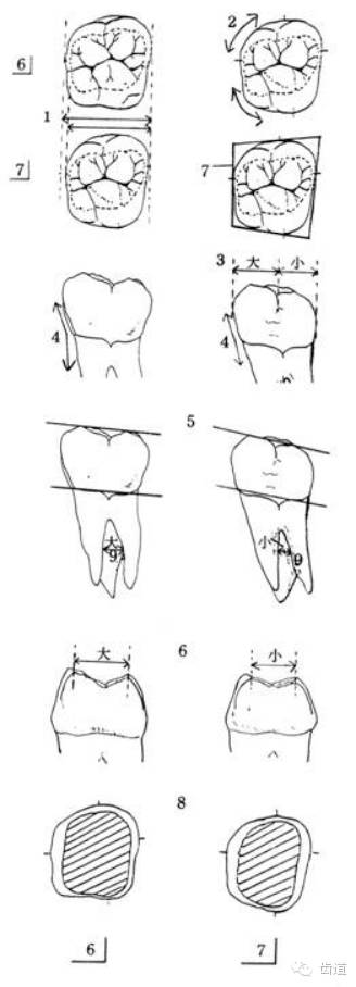 5.颊侧,舌侧的近中尖和远中尖的高度相差比较大.(颊侧比舌侧明显) 6.