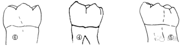 舌尖三角嵴明显,颊尖较圆钝. 16.中央窝位于颊舌向的中央靠