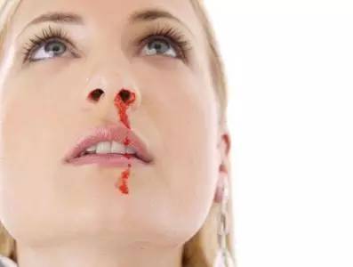 孕期鼻子出血是怎么回事