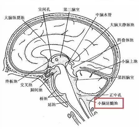 小脑延髓池异常,要想到的7个疾病【影像学院j030】