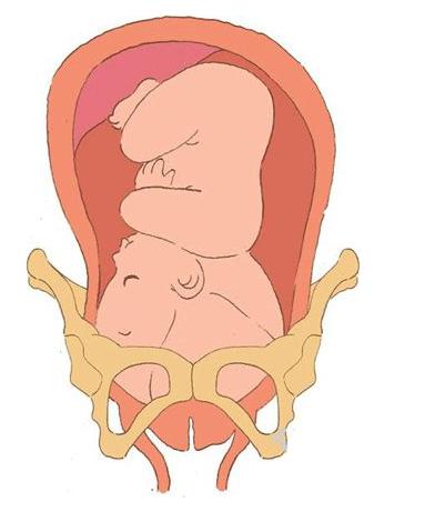 胎儿入盆是什么感觉?这6大信号告诉你该生了