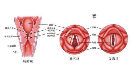 孩子急性喉炎怎么办