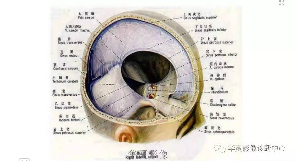 比较学习-硬膜外血肿及石硬膜下血肿相关问题