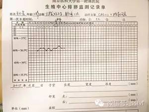 b超监测排卵,懂得这些事半功倍!