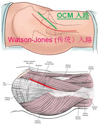 81岁老人口咽癌最佳治疗方法_口咽癌图片